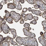 Atlas Antibodies Anti-WDFY1 Antibody