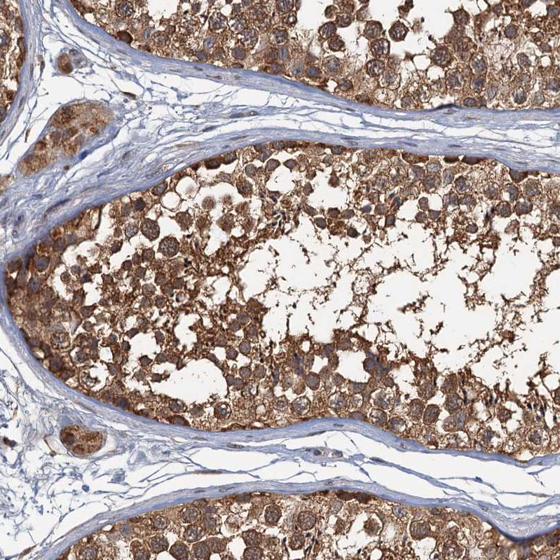 Atlas Antibodies Anti-WDCP Antibody