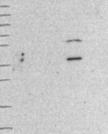 Atlas Antibodies Anti-WDFY2 Antibody