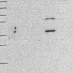 Atlas Antibodies Anti-WDFY2 Antibody