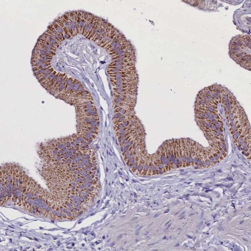 Atlas Antibodies Anti-WDFY3 Antibody