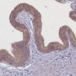 Atlas Antibodies Anti-WDFY3 Antibody