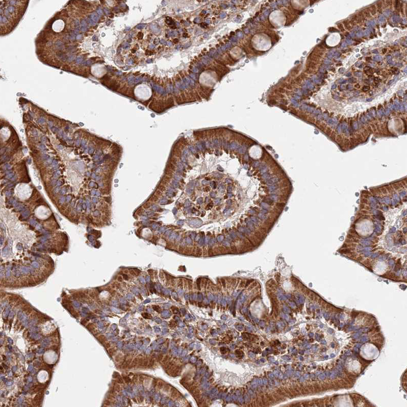 Atlas Antibodies Anti-WDFY3 Antibody
