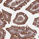 Atlas Antibodies Anti-WDFY3 Antibody