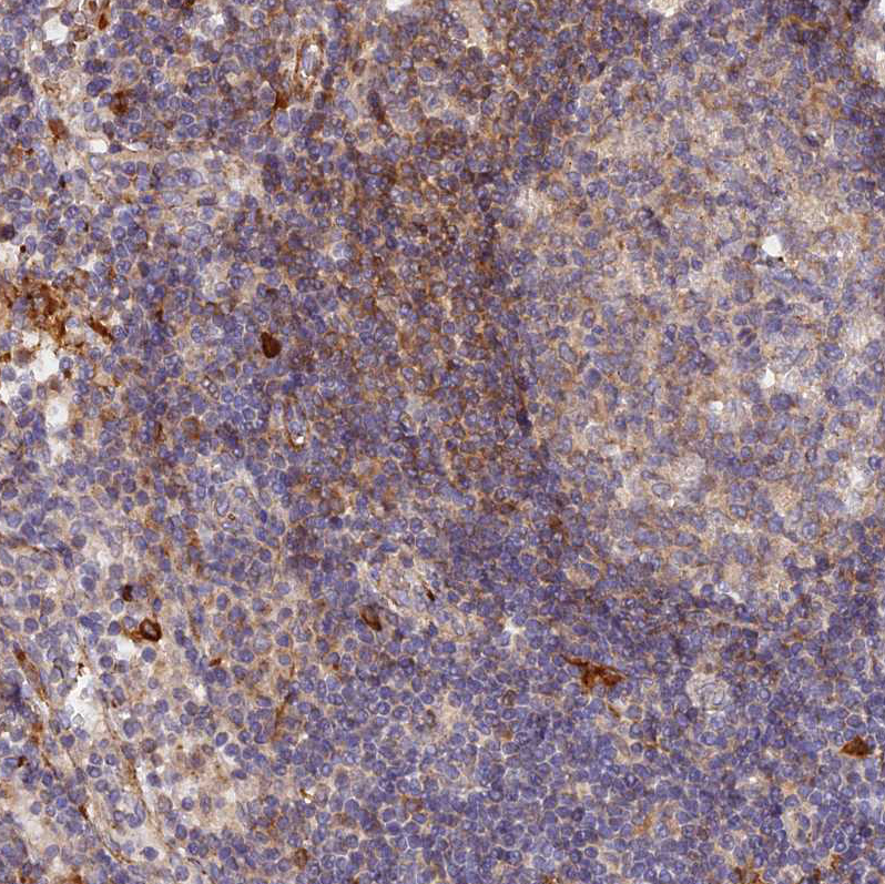 Atlas Antibodies Anti-WDFY4 Antibody