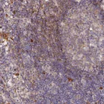 Atlas Antibodies Anti-WDFY4 Antibody