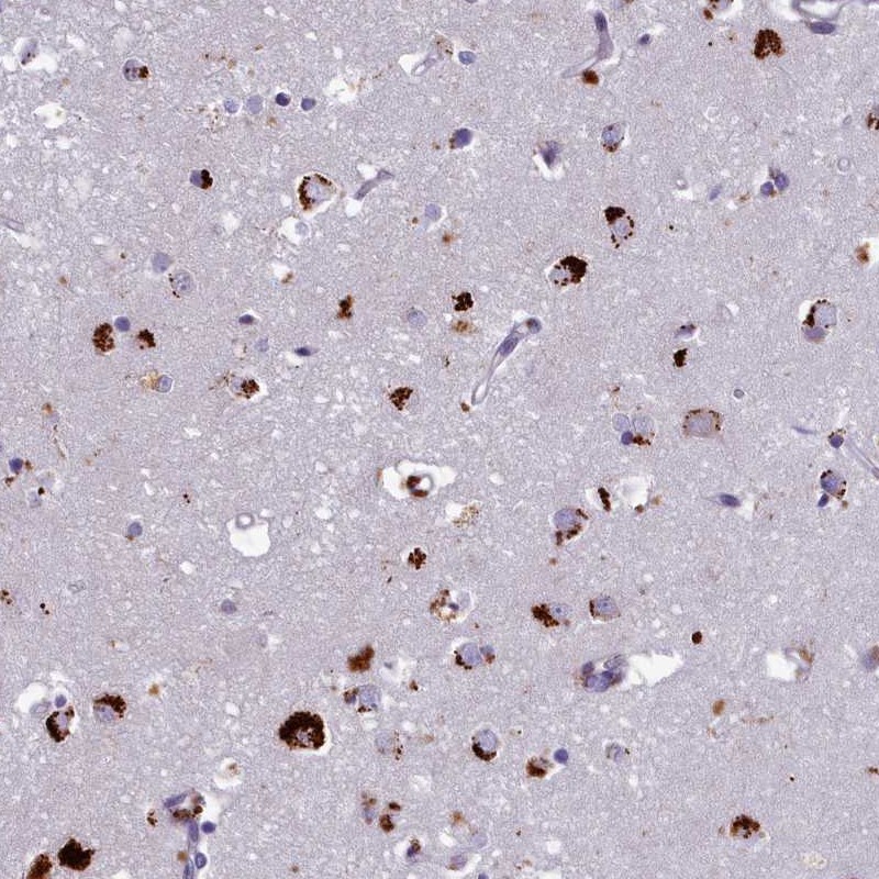 Atlas Antibodies Anti-WDPCP Antibody