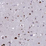 Atlas Antibodies Anti-WDPCP Antibody