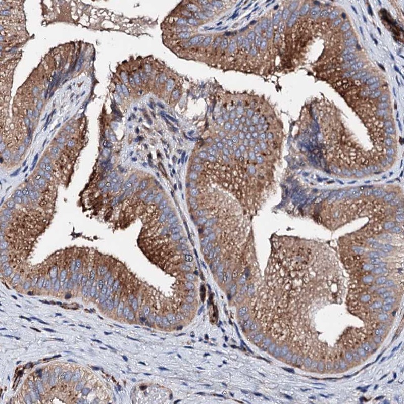 Atlas Antibodies Anti-WDR11 Antibody