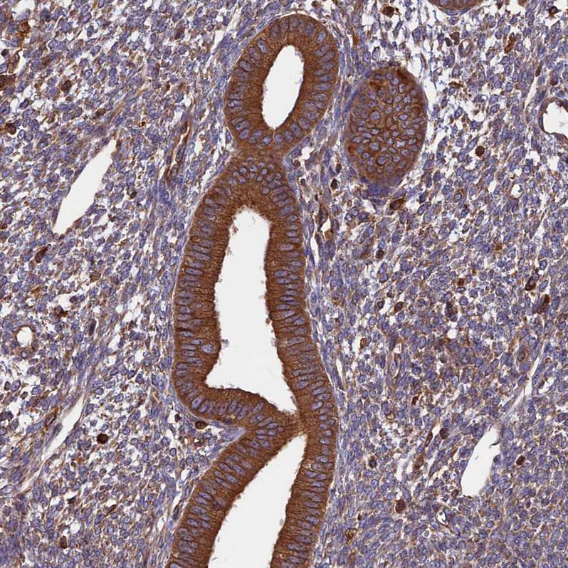 Atlas Antibodies Anti-WDR1 Antibody