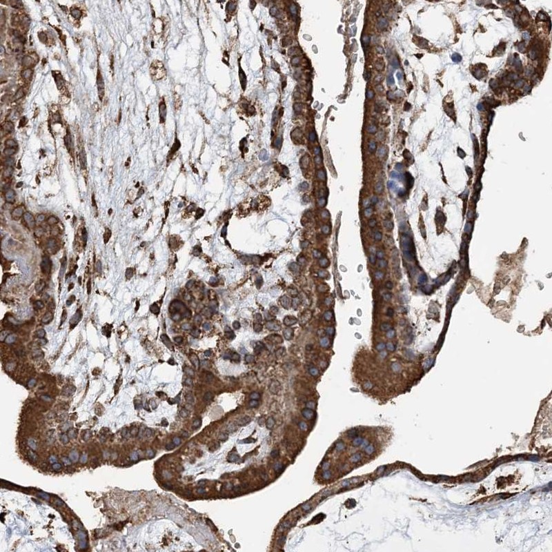 Atlas Antibodies Anti-WDR12 Antibody