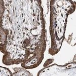 Atlas Antibodies Anti-WDR12 Antibody