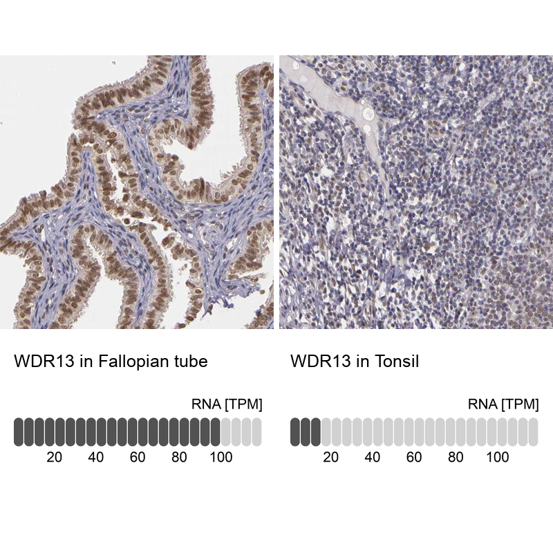Atlas Antibodies Anti-WDR13 Antibody