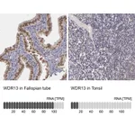 Atlas Antibodies Anti-WDR13 Antibody
