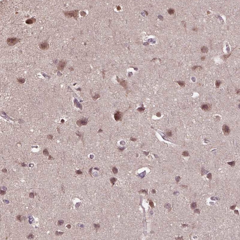 Atlas Antibodies Anti-WDR17 Antibody