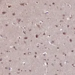 Atlas Antibodies Anti-WDR17 Antibody