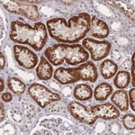 Atlas Antibodies Anti-WDR18 Antibody