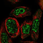 Atlas Antibodies Anti-WDR17 Antibody