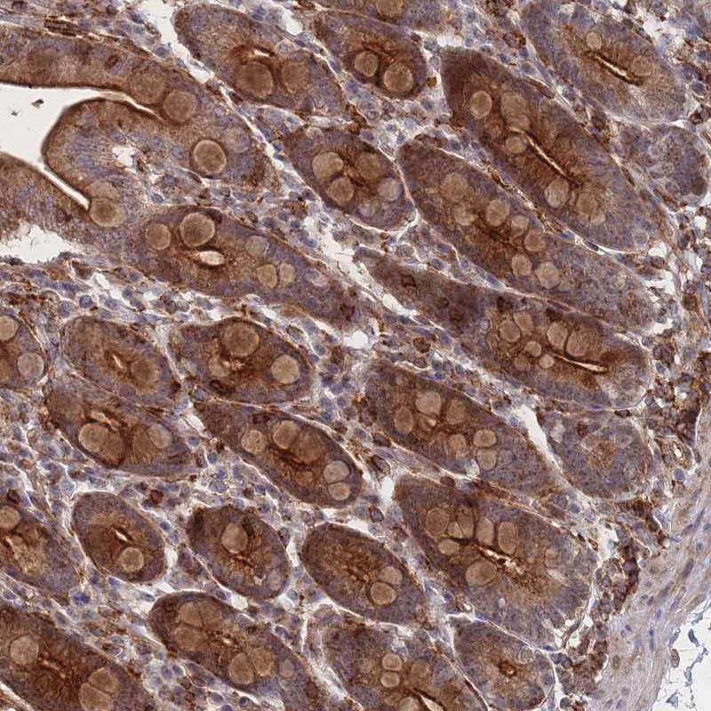 Atlas Antibodies Anti-WDR18 Antibody
