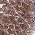 Atlas Antibodies Anti-WDR18 Antibody