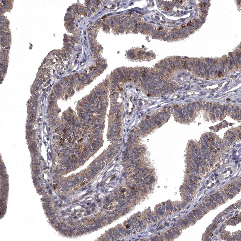 Atlas Antibodies Anti-WDR19 Antibody
