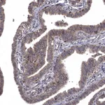 Atlas Antibodies Anti-WDR19 Antibody
