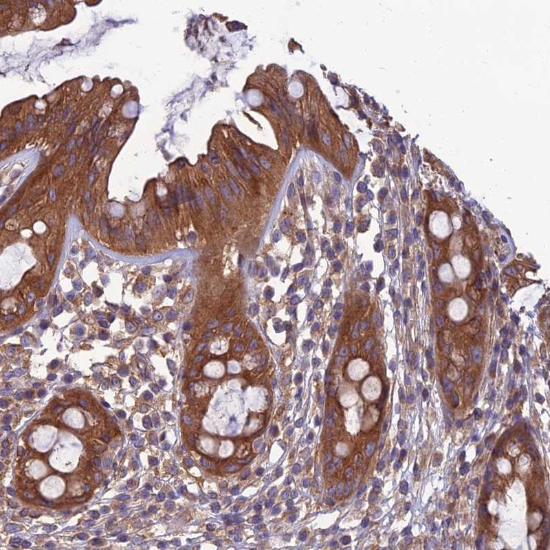 Atlas Antibodies Anti-WDR24 Antibody
