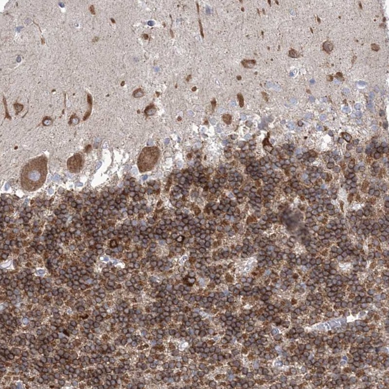 Atlas Antibodies Anti-WDR27 Antibody