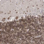 Atlas Antibodies Anti-WDR27 Antibody