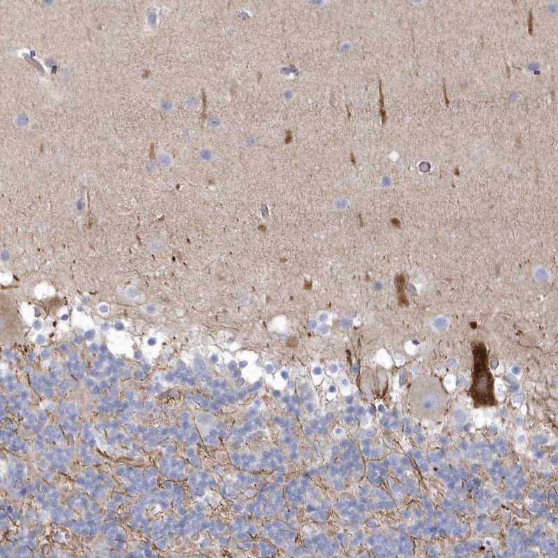 Atlas Antibodies Anti-WDR27 Antibody