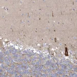 Atlas Antibodies Anti-WDR27 Antibody