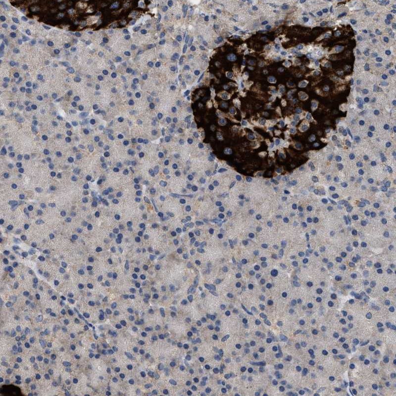 Atlas Antibodies Anti-WDR31 Antibody