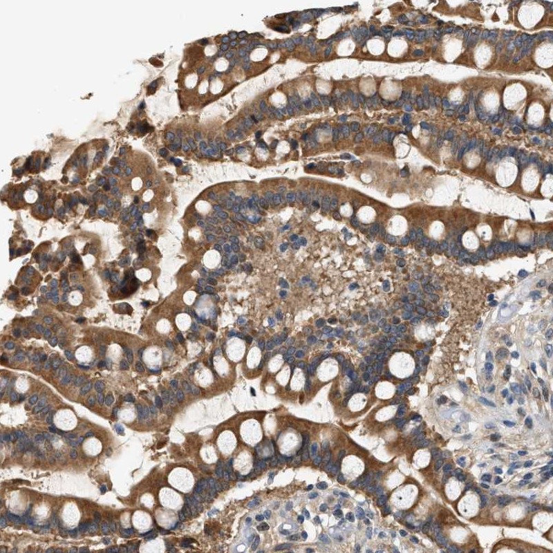 Atlas Antibodies Anti-WDR31 Antibody