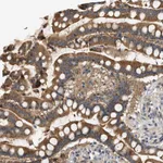 Atlas Antibodies Anti-WDR31 Antibody