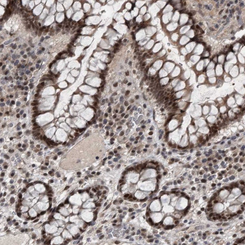 Atlas Antibodies Anti-WDR33 Antibody