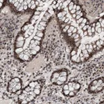 Atlas Antibodies Anti-WDR33 Antibody
