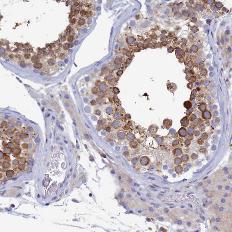 Atlas Antibodies Anti-WDR35 Antibody