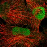 Atlas Antibodies Anti-WDR33 Antibody