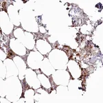 Atlas Antibodies Anti-WDR36 Antibody