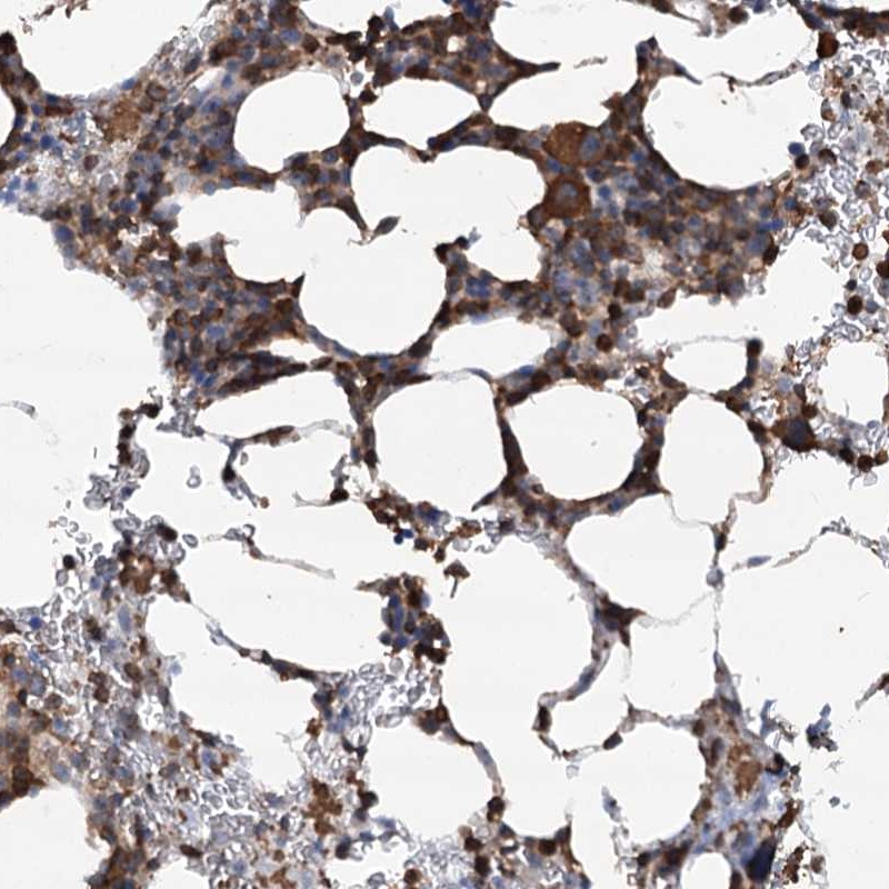 Atlas Antibodies Anti-WDR36 Antibody