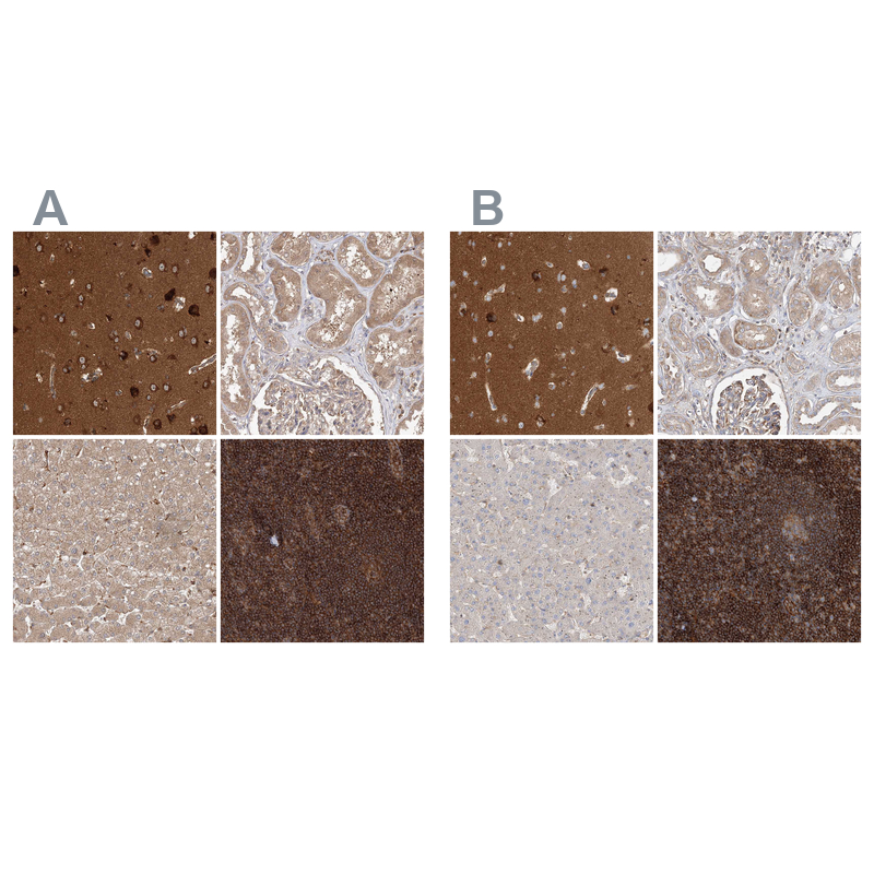 Atlas Antibodies Anti-WDR37 Antibody