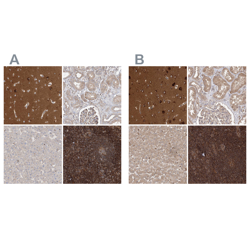 Atlas Antibodies Anti-WDR37 Antibody