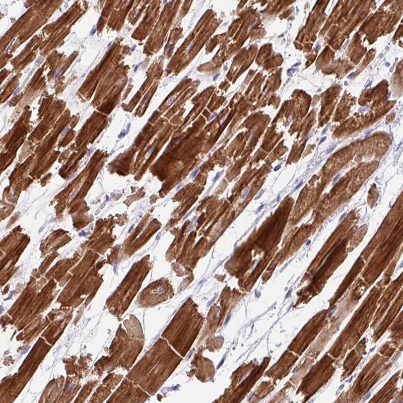 Atlas Antibodies Anti-WDR38 Antibody