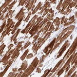 Atlas Antibodies Anti-WDR38 Antibody
