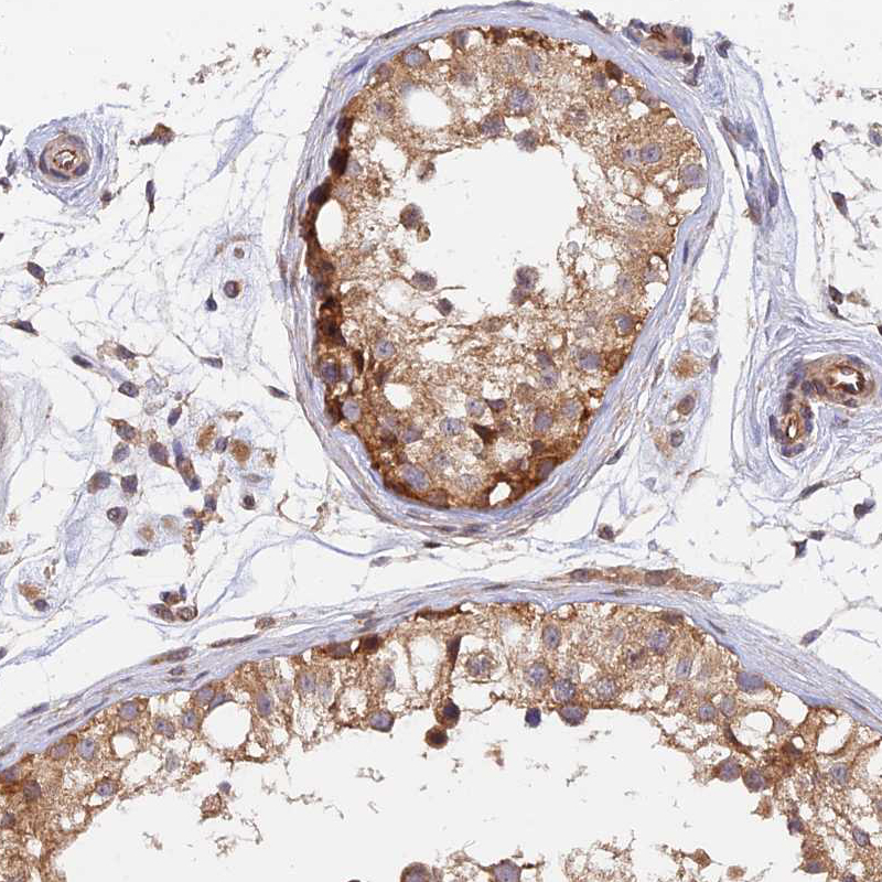 Atlas Antibodies Anti-WDR41 Antibody