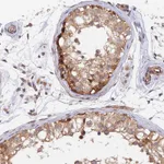 Atlas Antibodies Anti-WDR41 Antibody