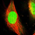 Atlas Antibodies Anti-WDR4 Antibody