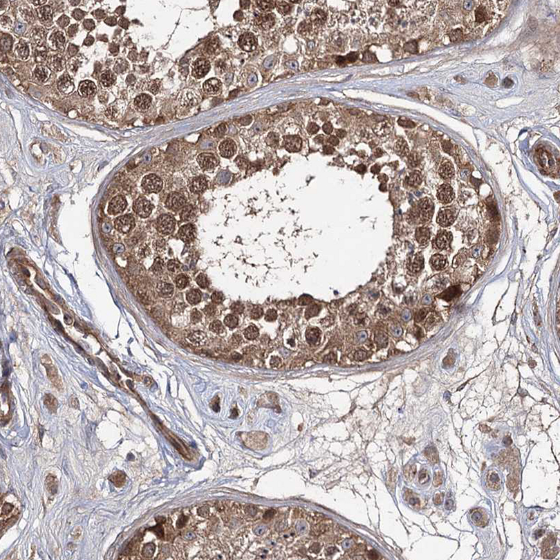 Atlas Antibodies Anti-WDR48 Antibody