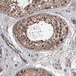Atlas Antibodies Anti-WDR48 Antibody