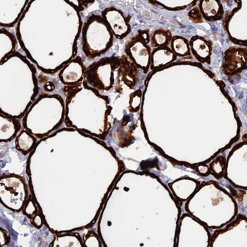 Atlas Antibodies Anti-WDR46 Antibody